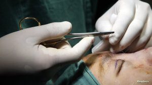 “كابوس” عبير وصور مروعة.. لبنانيون ضحايا فوضى عمليات التجميل في سوريا
